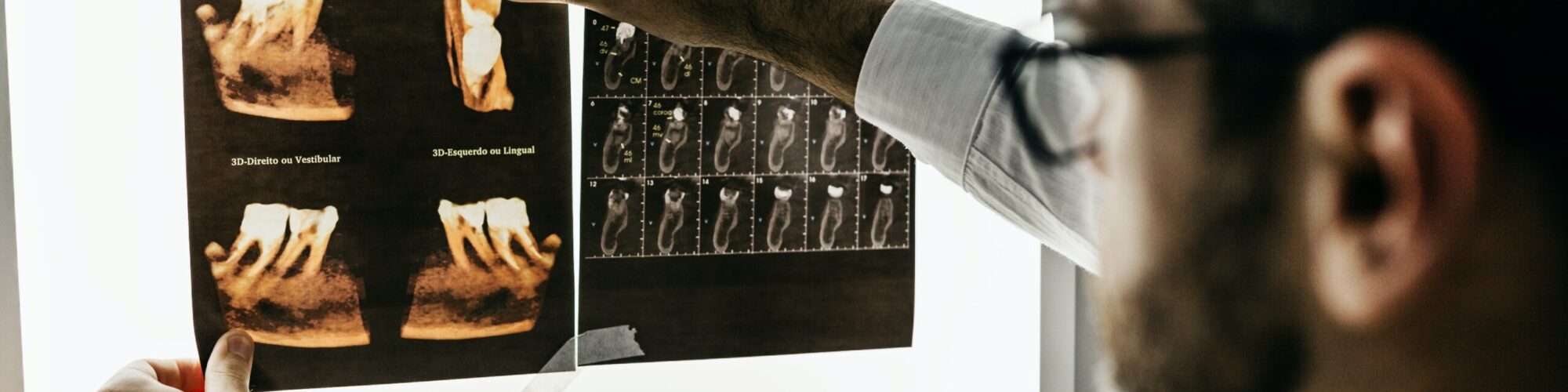 A dental professional examines an oral xray