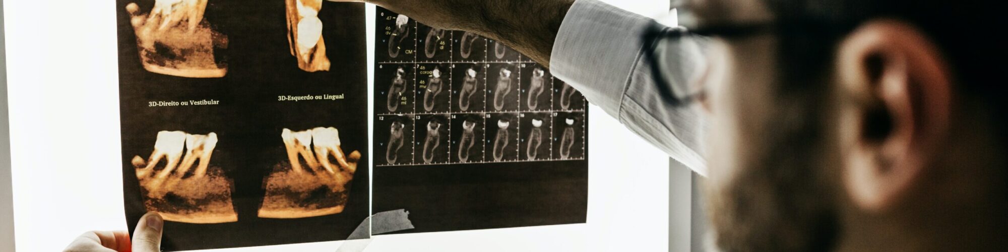 jonathan-borba-v_2FRXEba94-unsplash A dental professional examines an oral xray